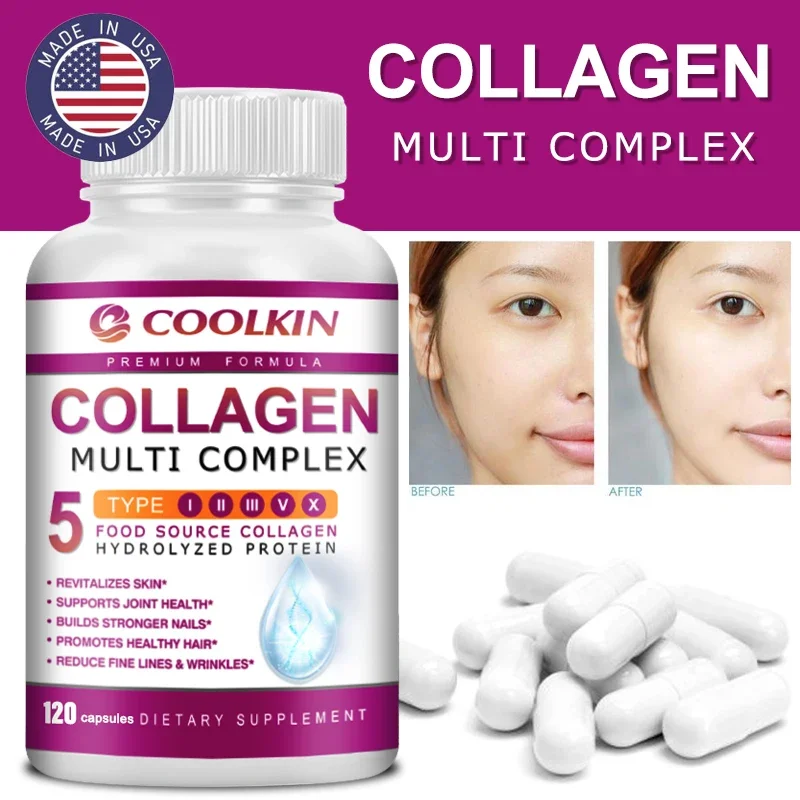 Coffee X - Collagen Multi Complex — типы I,